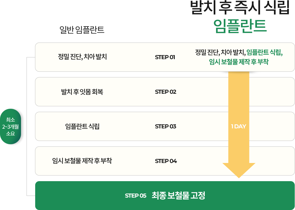 일반 임플란트 VS 발치 후 즉시 식립 임플란트